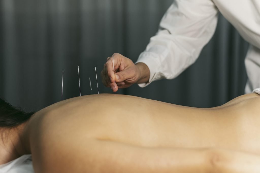 Acupuncturist in Amersfoort